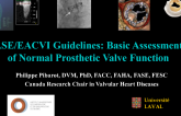 ASE/EACVI Guidelines: Basic Assessment of Normal Prosthetic Valve Function