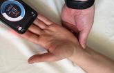 Smartphone Heart Rate-Monitoring App Can Accurately Assess Radial Artery Patency 