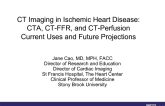 CT Imaging in Ischemic Heart Disease: CTA, CT-FFR, and CT-Perfusion Current Uses and Future Projections