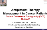 Antiplatelet Therapy Management in Cancer Patients: Optical Coherence Tomography (OCT) Guided?