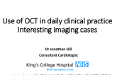 Use of OCT in daily clinical practice Interesting imaging cases