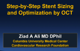 Step-by-Step Stent Sizing and Optimization by OCT