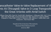Transcatheter Valve-in-Valve Replacement of the Systemic AV (Tricuspid) Valve in D-Loop Transposition of the Great Arteries With Atrial Switch