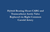 Hybrid Beating Coronary Artery Bypass Grafting and Transcatheter Aortic Valve Replacement via Right Carotid Artery Access in a Patient With Severe Peripheral Arterial Disease