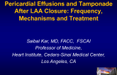 Pericardial Effusions and Tamponade After LAA Closure: Frequency, Mechanisms, and Treatment (With Cases)