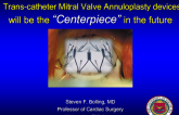 Transcatheter Mitral Annuloplasty Devices Will Be the "Centerpiece" in the Future