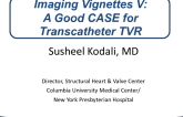 Imaging Vignettes V: A Good CASE for Transcatheter TVR