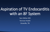 Aspiration of TV Endocarditis With an 8F System