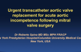 Urgent Transcatheter Aortic Valve Replacement for Severe Acute Aortic Regurgitation Following Open Mitral Valve Surgery