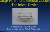 Large Hole Transfemoral Closure II: The InSeal Device