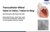 Mitral Valve-in … Valve and Ring I: Insights From the VIVID Registry