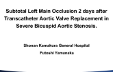 Subtotal Left Main Occlusion Two Days After Transcatheter Aortic Valve Replacement in Severe Bicuspid Aortic Stenosis