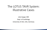 The LOTUS TAVR System: Illustrative Cases (Eg, Extreme Calcification, Bicuspid Valves)