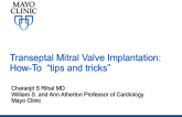 Technical Tips and Tricks (Step-by-step) to Successfully Perform Trans-septal Mitral Valve-in Procedures