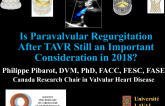 Is Paravalvular Regurgitation After TAVR Still an Important Consideration in 2018?