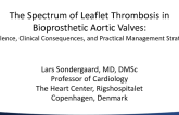 The Spectrum of Leaflet Thrombosis in Bioprosthetic Aortic Valves - Prevalence, Clinical Consequences, and Practical Management Strategies