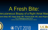 A Fresh Bite: Percutaneous Biopsy of a Right Atrial Mass