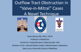 Minimizing Left Ventricular Outflow Tract Obstruction in “Valve-in-Mitral” Cases: A Novel Technique