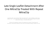 Late Single Leaflet Detachment After Mitraclip Treated With Redo MitraClip