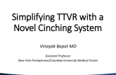 Simplifying TTVR With a Novel Cinching System