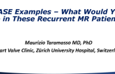 Case Examples: What Would You Do in These Recurrent MR Patients?