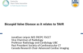 A CT Imaging Perspective of Bicuspid Aortic Valve Disease – Anatomic Patterns Favorable for TAVR