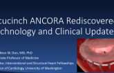 Accucinch ANCORA Rediscovered: Technology and Clinical Updates (EFS)