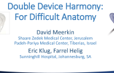 Double Device Harmony for Challenging Anatomy