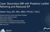 A Case of Secondary MR With Severe Posterior Leaflet Tenting and Reduced EF