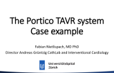 The PORTICO TAVR System: Illustrative Cases (Eg, Low Coronaries)