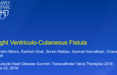 Right Ventriculocutaneous Fistula