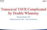 Transcaval TAVR Complicated by Double Wammy