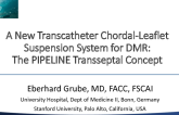 A New Transcatheter Chordal-Leaflet Suspension System for DMR: The PIPLINE Trans-septal Concept