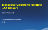 Trans-septal Puncture for LAA Closure: The Right Way and the Wrong Way