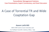 A Case of Torrential TR and Wide Coaptation Gap