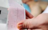 Do Not Screen Asymptomatic Adults For CVD With ECGs, Says USPSTF 