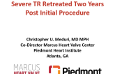 Severe Tricuspid Regurgitation Retreated at Two Years Post Initial Procedure With Transcatheter Repair