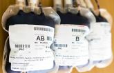 VTE Risk Higher in Surgical Patients Who Get Transfusions