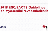 2018 ESC/EACTS Guidelines on Myocardial Revascularization