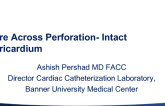 Wire Across Perforation- Intact Pericardium