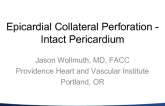 Epicardial Collateral Perforation - Intact Pericardium