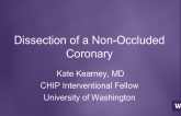 Dissection of a Non-Occluded Coronary 