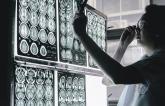Reducing CV Risk May Improve Brain Health at Any Stage in Life, Studies Hint