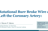 Rotational Burr Broke Wire and Left the Coronary Artery