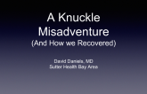 A Knuckle Misadventure  (And How we Recovered)