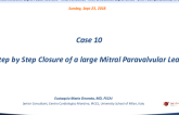 Case #10: Step-by-Step Closure of a Large Mitral Paravalvular Leak