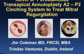 Novel 5F Percutaneous Transapical Annuloplasty A2–P2 Cinching System to Treat Mitral Regurgitation (Trinitas)