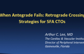 When Antegrade Fails: Retrograde Crossing Strategies for SFA CTOs