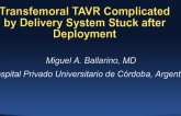 Case 5 From Argentina: Transfemoral TAVR Complicated by Stuck Delivery System After Deployment