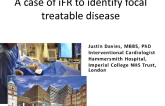 Case #5: A Case of iFR Co-Registration To Identify Focal Treatable Disease